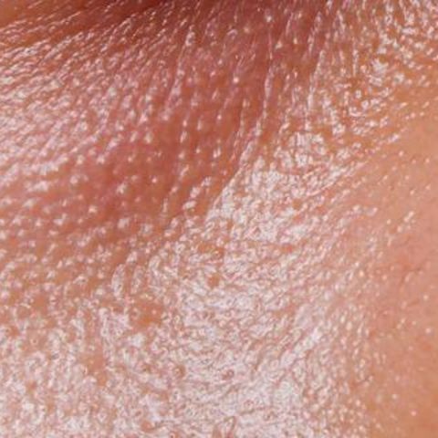 hud i ansigtet – årsager og