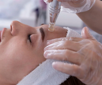 Microneedling: Hvad er det, hvordan virker det, og hvad kan du forvente?